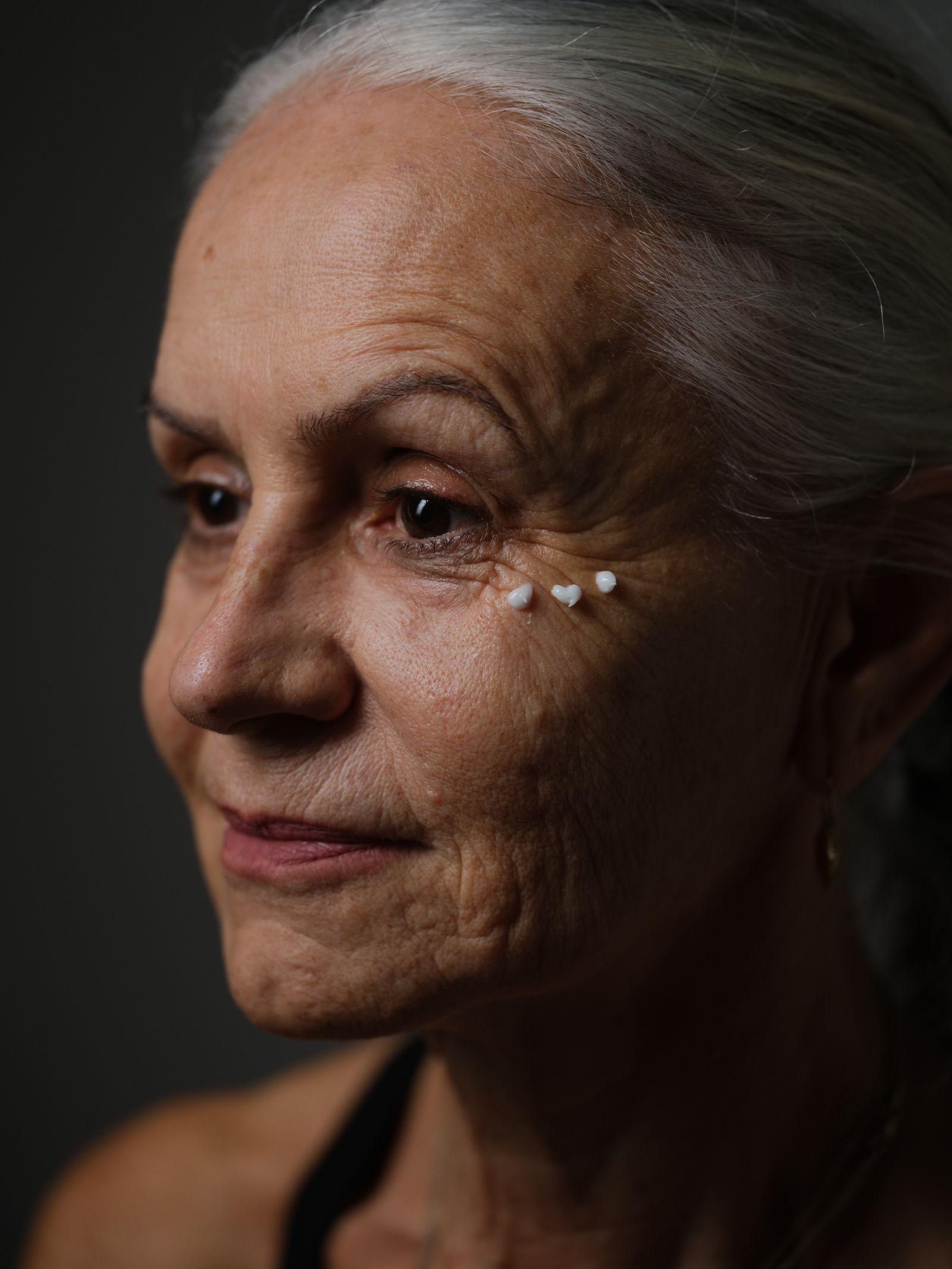 Facial Rejuvenation in Santo Domingo - Plastica del Caribe